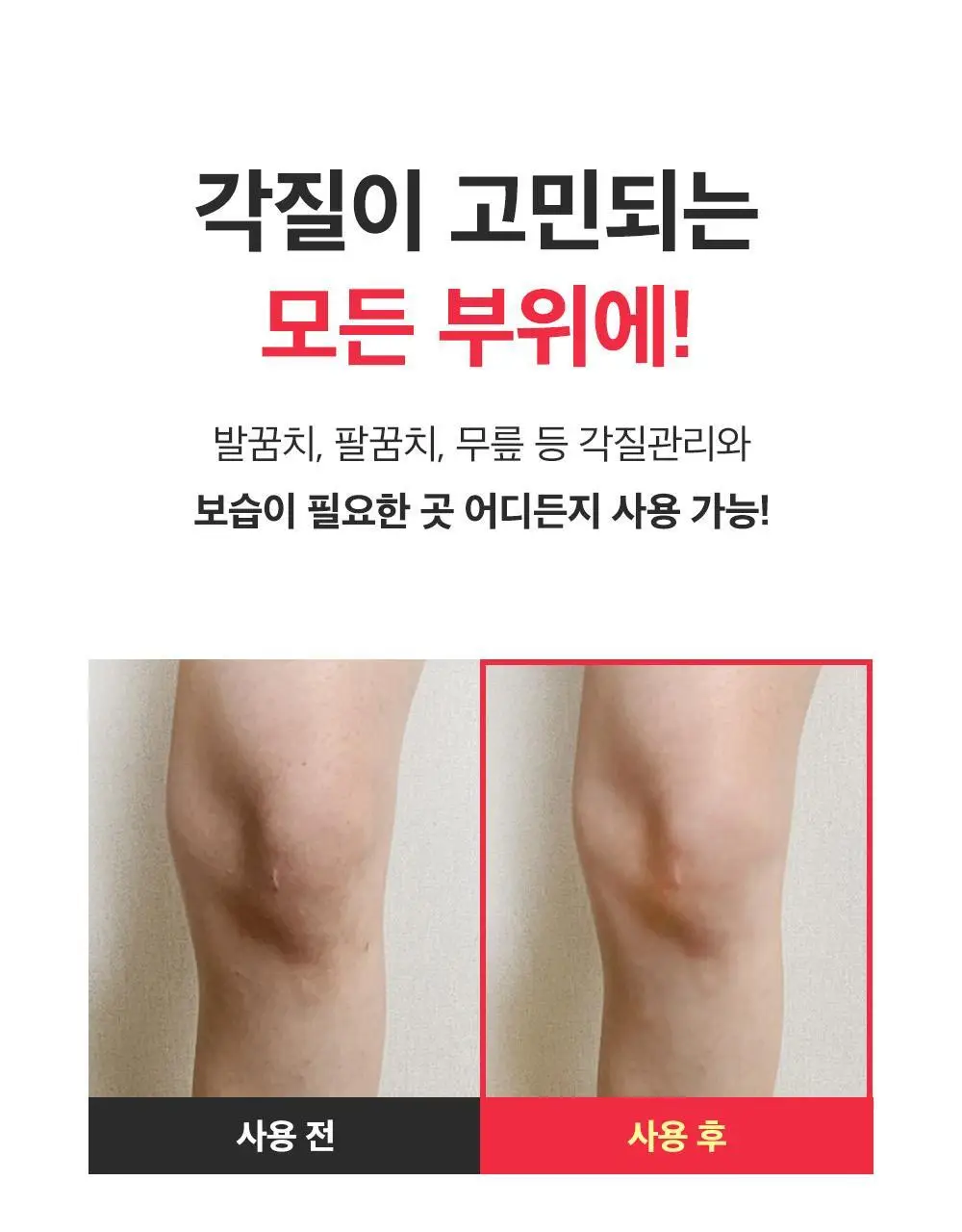 [데일리풋케어/맨들맨들아기발] 성분에디터 시어버터 베이비 풋 스틱 20g 2종 택 1 상세페이지 31